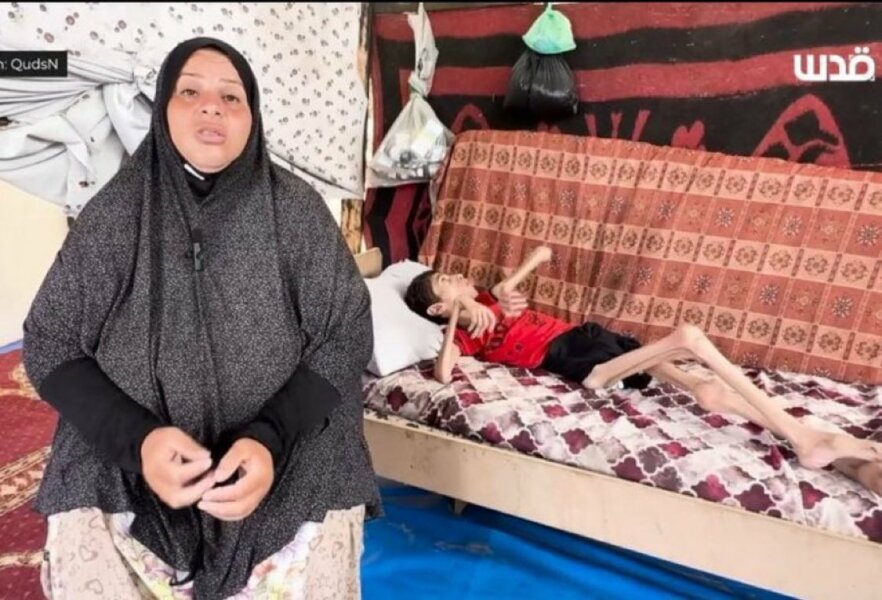 Malnourished starving children in Gaza