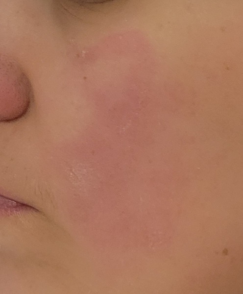 Skin and me -normal?