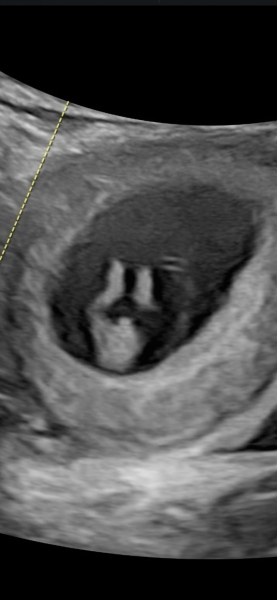10 week scan - what's your thoughts?