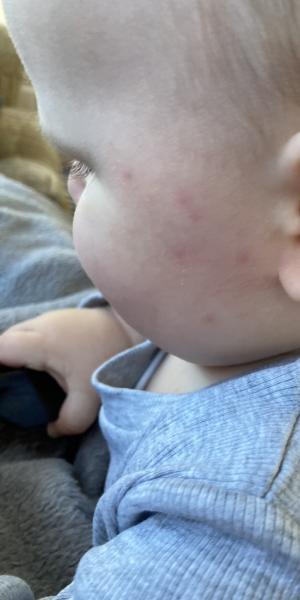 What does this look like to you? (Baby spots)