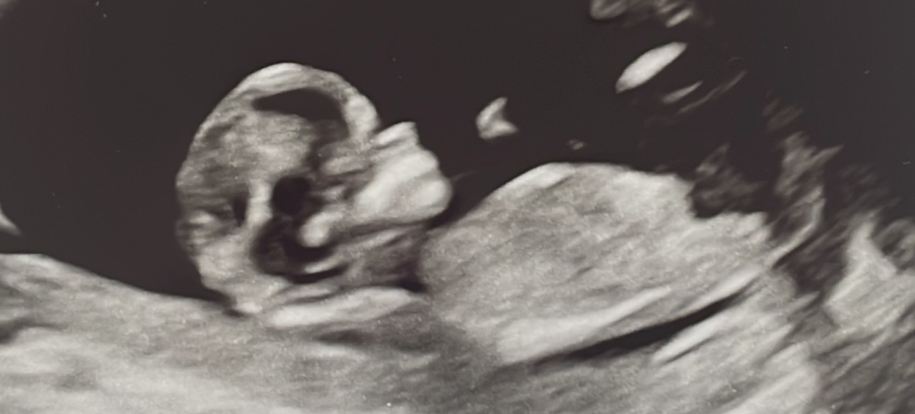 Nub experts - is this a girl or a boy?