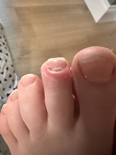 What is this?! (Toe)