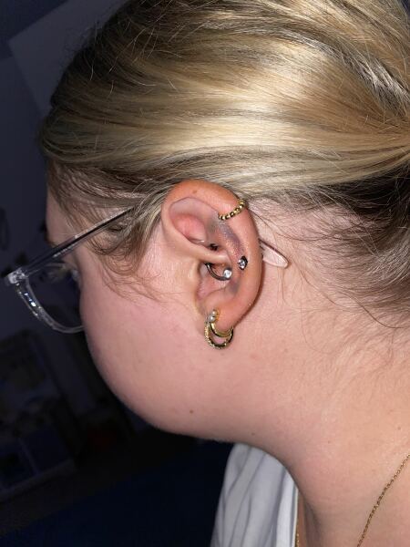 Is this normal on a piercing?