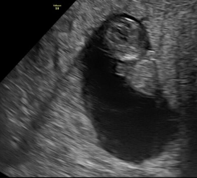 4w5d test still not dark solid