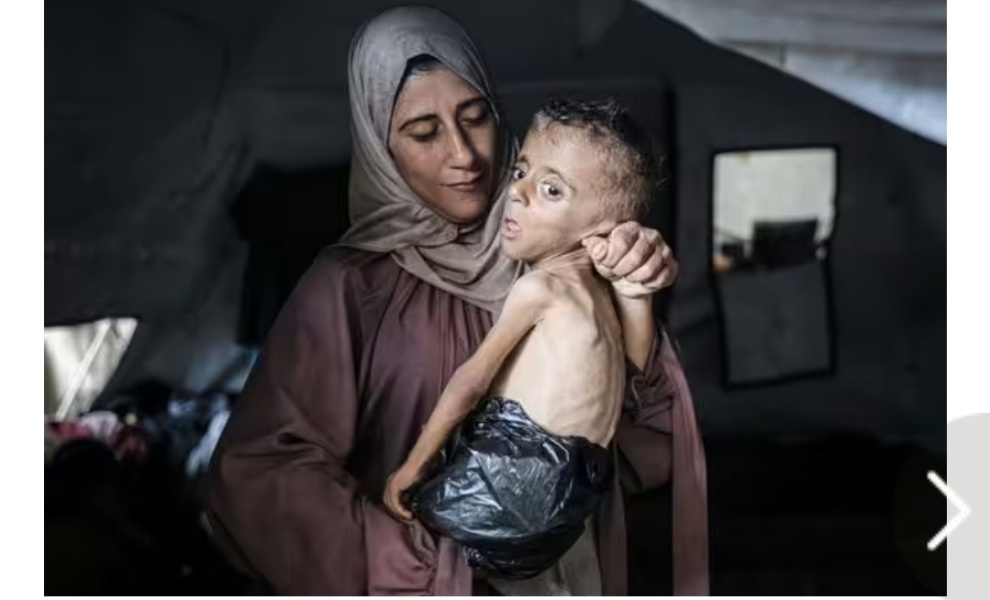 How is forced starvation allowed?