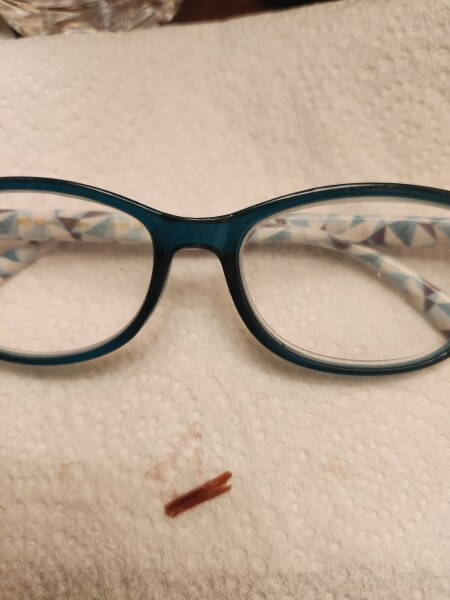 Do I need an antibiotic?