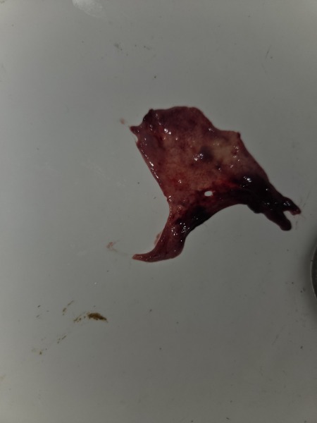 Tmi pic attached..weird clot during period