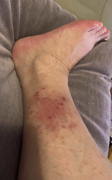 Skin nasty (photo). Help!
