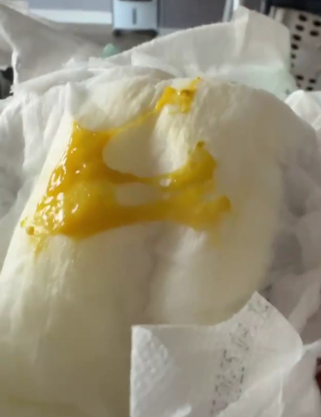 Mucus in newborns poo (sorry nappy pic)