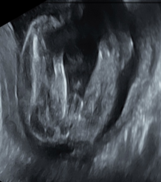 Boy or girl?