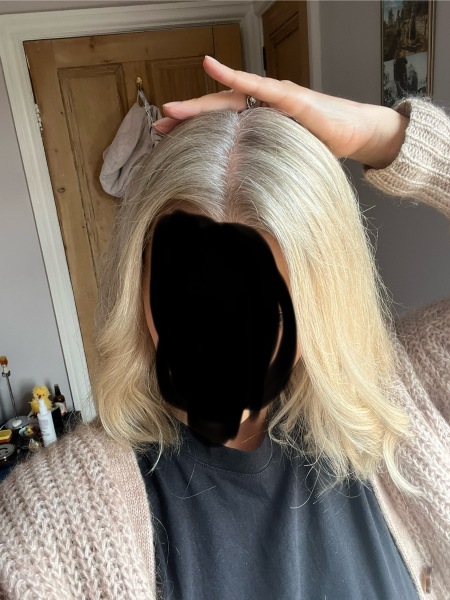 Roots - what are my best options