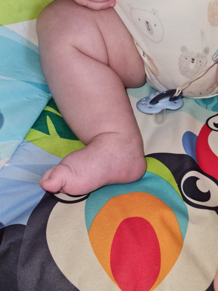 Baby breathing, subcostal retractions :(