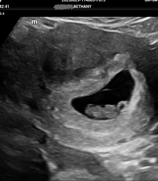 Faint line at 12dpo?