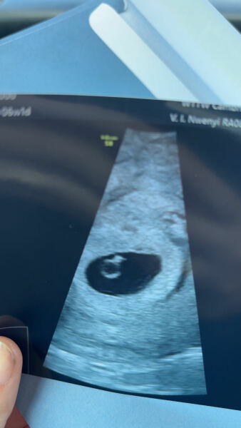 5 week scan…