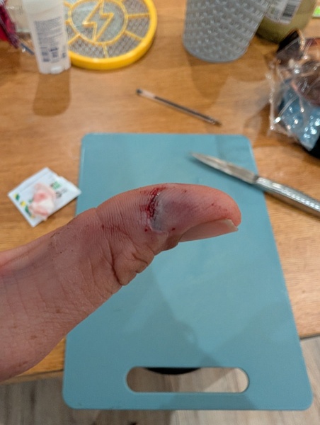 Does this cut look bad? (Picture attached)