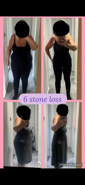 Mounjaro 10st or more to lose - Thread 5