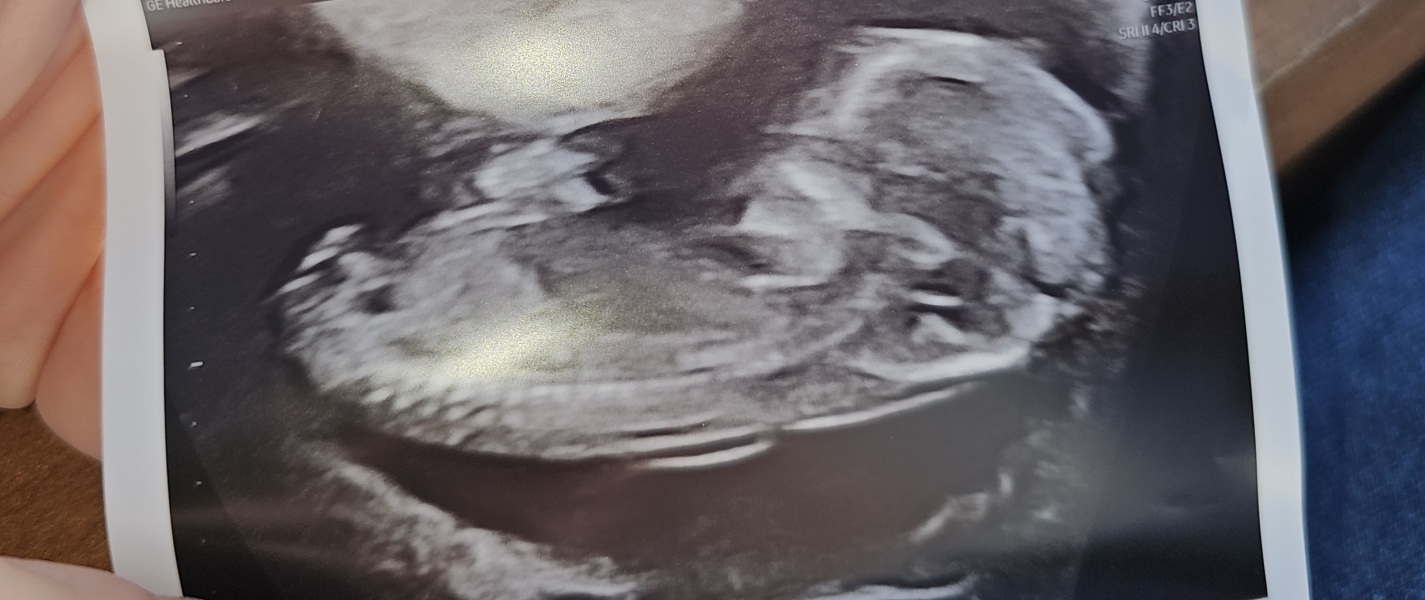 Due January 2026 - thread 2