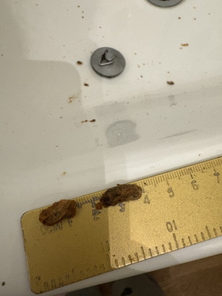 Look what I just flushed out my ears