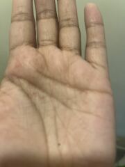 Black round hard balls found on daughters  scalp