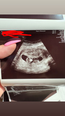 11.2 what do we think?