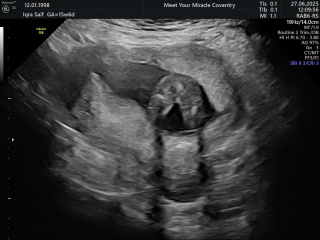 Baby gender 16 weeks scan
