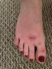Identify my bites!
