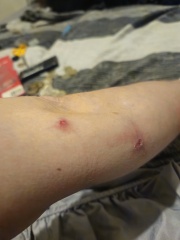 Identify my bites!