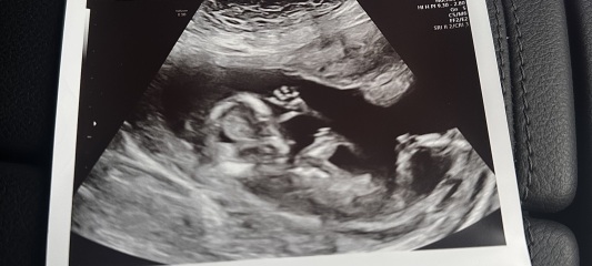 Any guesses for fun on my rainbow baby??!!!