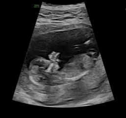 Anyone want me to take a look at their nubs?