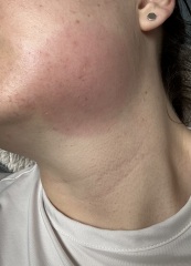 Should I go to A&E?