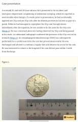 2 year old daughter swallowed a 50p coin !!!