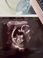 Placenta position?