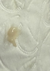 Is this implantation bleeding? 8dpo