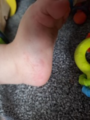 Calling parents and medical professionals please.