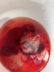 TMI warning ⚠️ Miscarriage 6 weeks