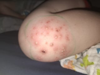 Is this a tonight emergency or can it wait to tomorrow?