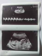 Boy or girl???