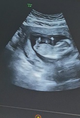 What do you see?
