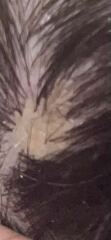 Scalp growth (pics included)