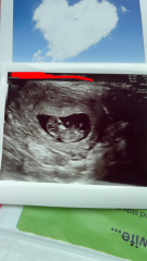 Fun gender guess 🤍