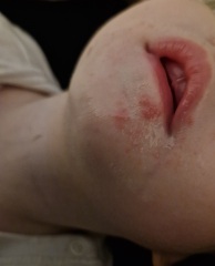 Does anyone know what this rash(?) could be?