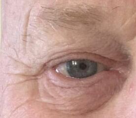 Eye colour