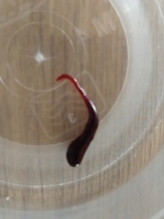 Have I just passed a polyp? Gross pic attached sorry!