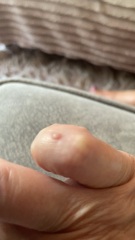 To ask you to identify this little lump?