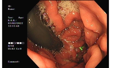 2 year old daughter swallowed a 50p coin !!!