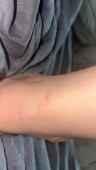 Bed Bugs?