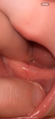 tooth or something to be concerned about?