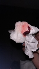 Is this a miscarriage?