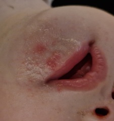 Does anyone know what this rash(?) could be?