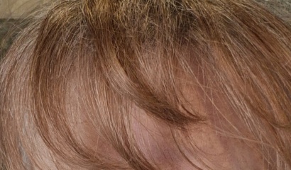 What colour hair dye?